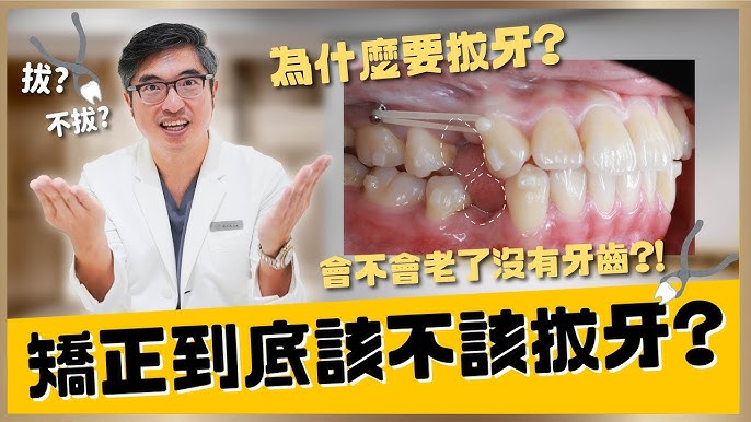 牙齿矫正到底需不需要拔智齿？牙齿矫正拔牙与不拔牙到底有什么优缺点？